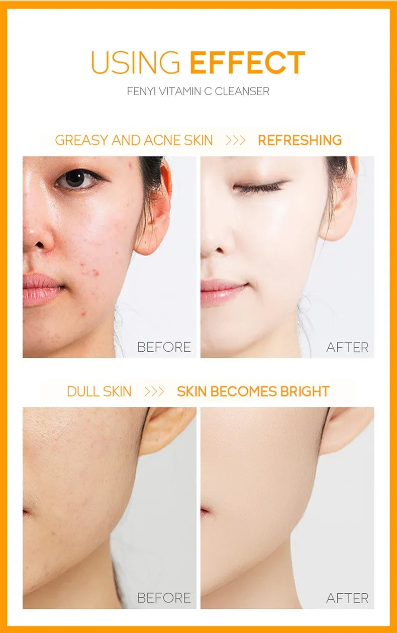 Vitamin C Facial Cleanser Skin Cleansing Moisturizing Blackhead Remove Skincare Face Wash Foam Face Cleanser 50g