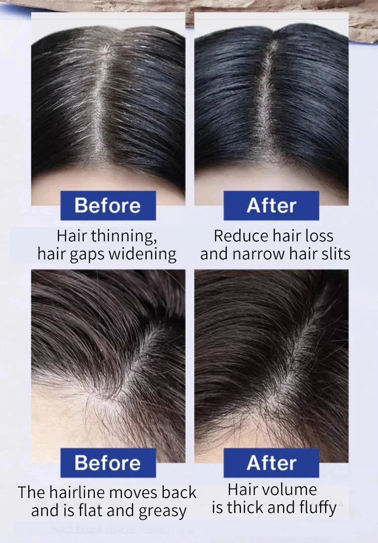 FEG Hair Loss and Strengthening Hair Care Oil For Men And Women