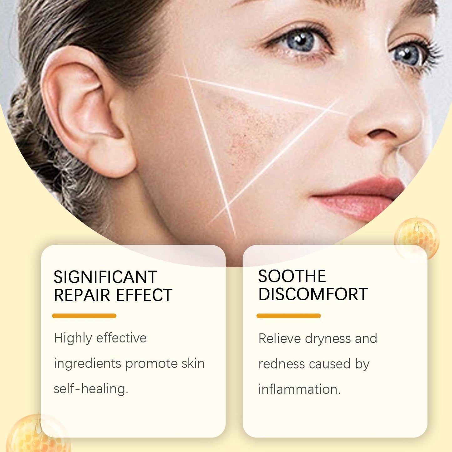 Houkeya Bee Skin Care Cream - Mole Removal & Moisturizing