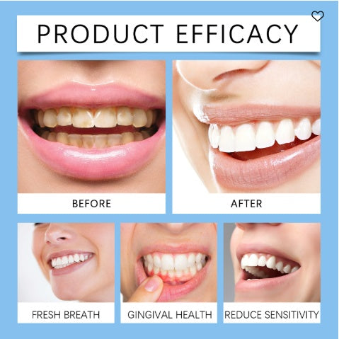 Oralhoe Coconut Mint Oil, Coconut Mint Mouthwash  Breath Care Gum Stain Removal Mouthwash