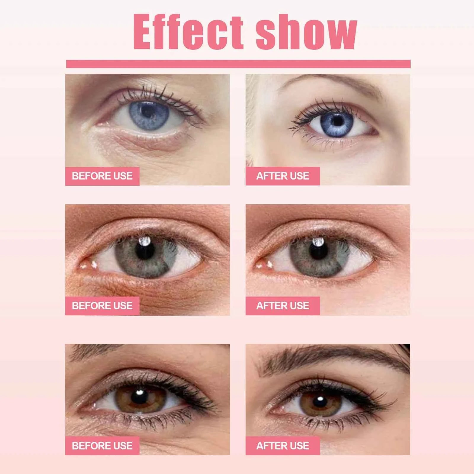 Rosehip Eye Cream Stick Reduce Dark Eyes Circles Remove Wrinkles Fine Lines Around Eyes Anti Aging Lifting Firming Eye Cream