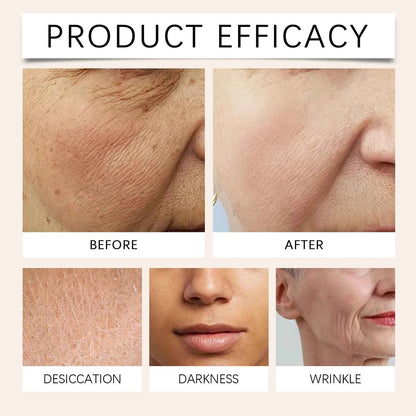 Turmeric Vitamin C Face Cream Anti Aging Skin Tighten Reduce Wrinkles Fine Lines Hydrate Nourish Skin Gentle Moisturizing Cream