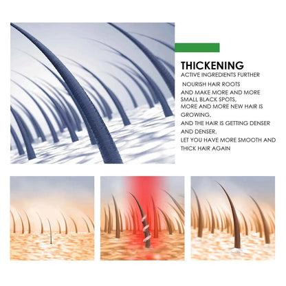 Black Castor Oil Nourishes Hair Growth Care Massage Scalp Treatment Baldness Repair Hydrates Liquid Anti Frizz Loss Hair Serum