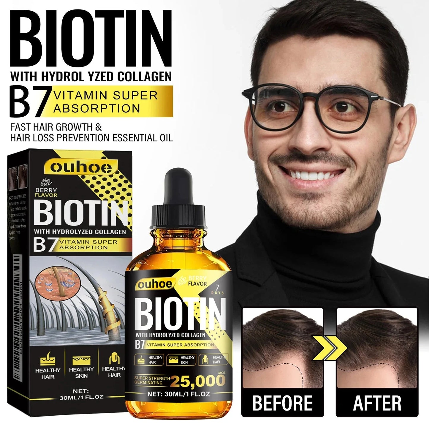 Ouhoe 30ml Collagen B7 Vitamin Hair Care Essential Oil Anti Hair Loss Moisture Repair Baldness Scalp Care Hair Growth Serum Oil