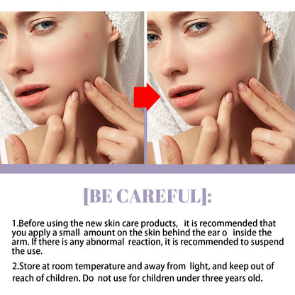 Eelhoe 40g Green Tea Cleansing Solid Face Mask Stick Acne Treatment Oil Control Moisture Remove Blackhead Clean Pores Face Mask - AMULET RING STORE