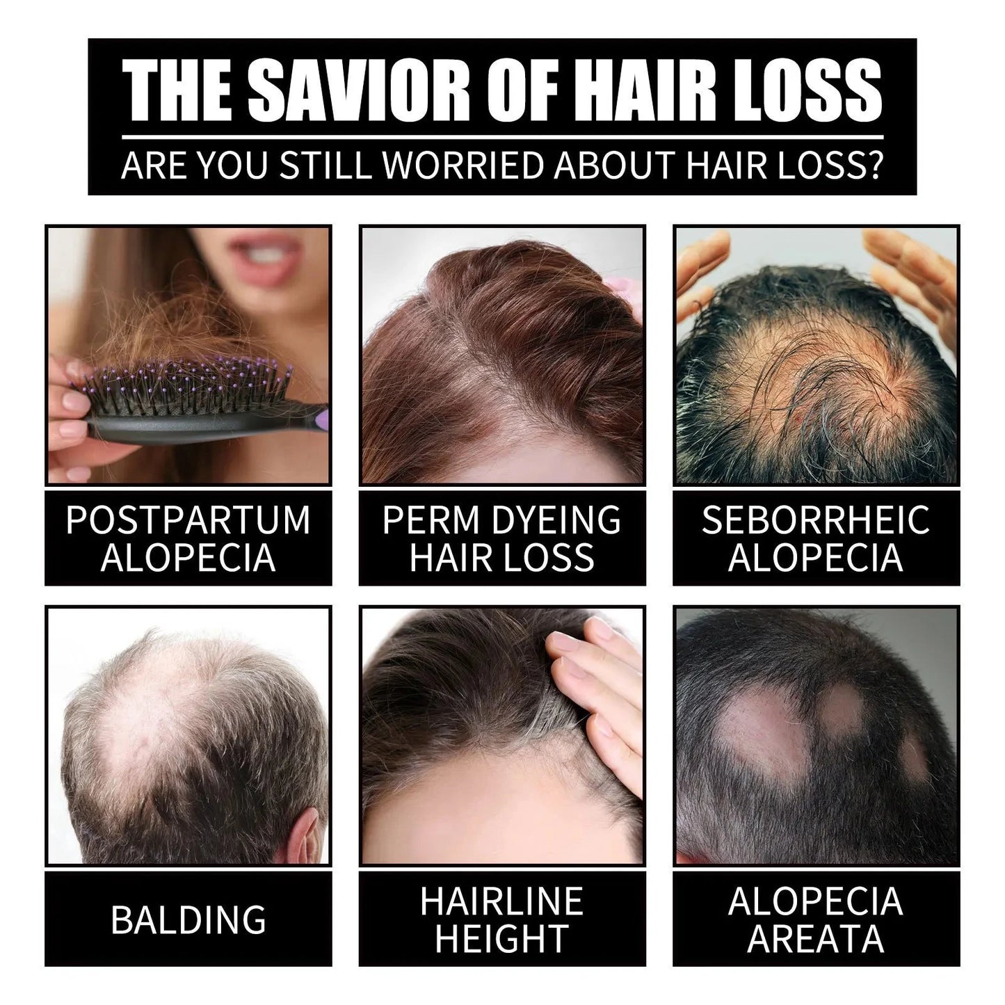 Ouhoe 30ml Collagen B7 Vitamin Hair Care Essential Oil Anti Hair Loss Moisture Repair Baldness Scalp Care Hair Growth Serum Oil