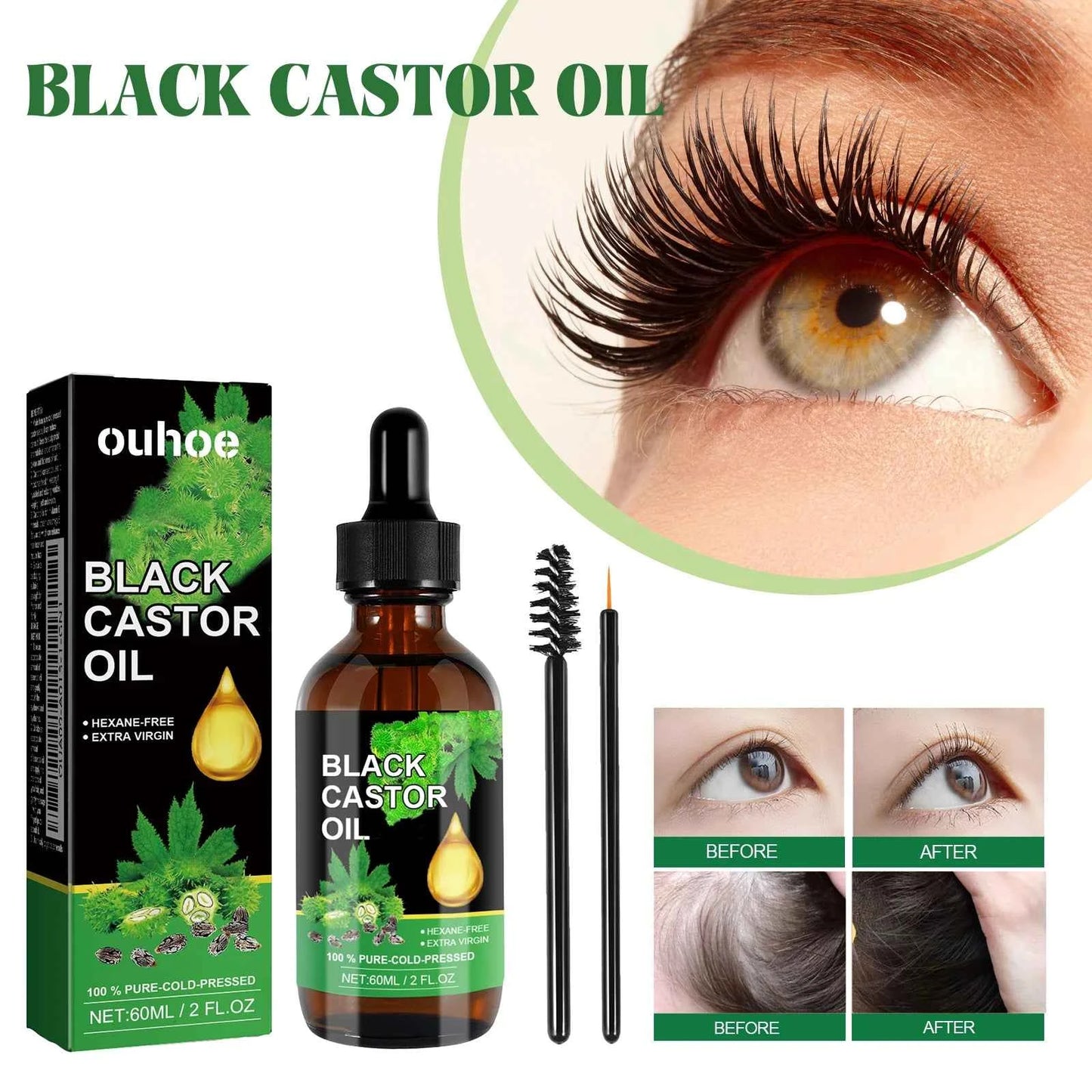 Black Castor Oil Nourishes Hair Growth Care Massage Scalp Treatment Baldness Repair Hydrates Liquid Anti Frizz Loss Hair Serum