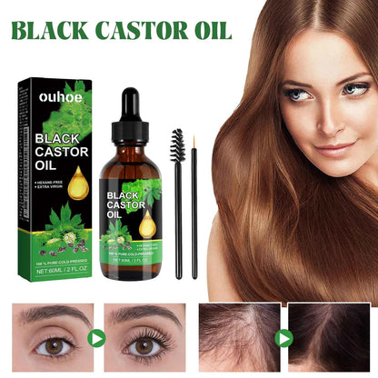 Black Castor Oil Nourishes Hair Growth Care Massage Scalp Treatment Baldness Repair Hydrates Liquid Anti Frizz Loss Hair Serum