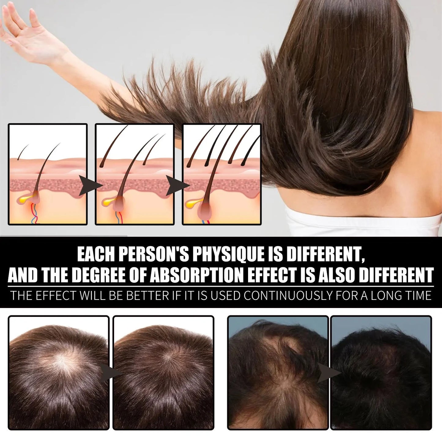 Ouhoe 30ml Collagen B7 Vitamin Hair Care Essential Oil Anti Hair Loss Moisture Repair Baldness Scalp Care Hair Growth Serum Oil