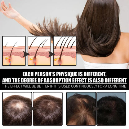 Ouhoe 30ml Collagen B7 Vitamin Hair Care Essential Oil Anti Hair Loss Moisture Repair Baldness Scalp Care Hair Growth Serum Oil