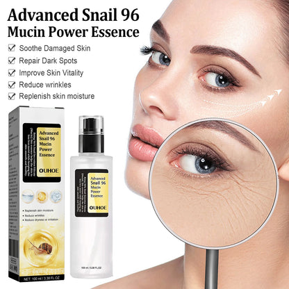 Ouhoe 96% Snail Mucin Skin Care Essence 92% Moisturizer Anti Aging Firming Facial Whitening Repair Dry Serum For Sensitive Skin