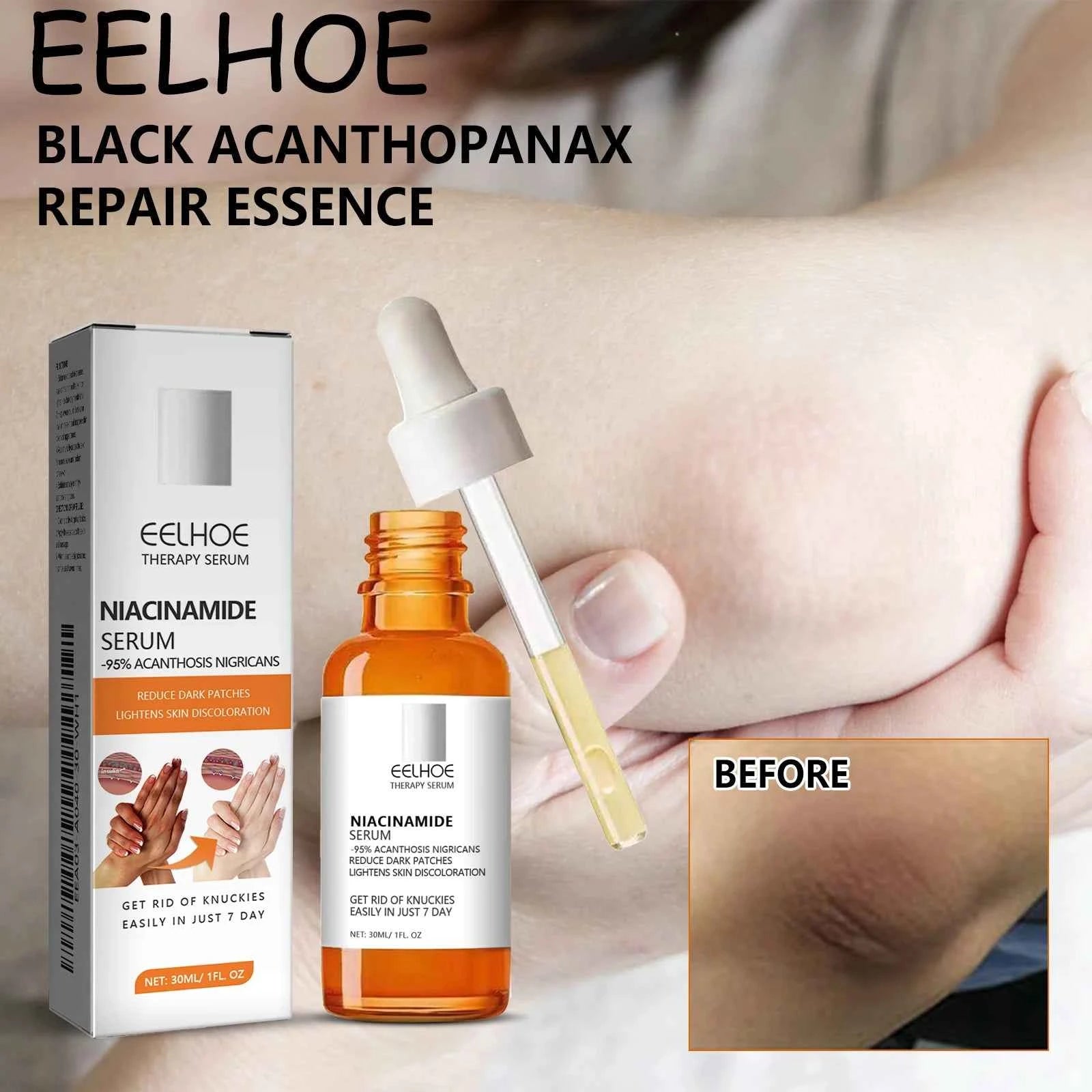 EELHOE Face Whitening Serum Reduce Dullness Brightening Skin Tone Moisturizing Enhance Skin Elasticity Body Skin Care Serum
