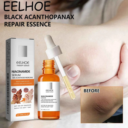 EELHOE Face Whitening Serum Reduce Dullness Brightening Skin Tone Moisturizing Enhance Skin Elasticity Body Skin Care Serum