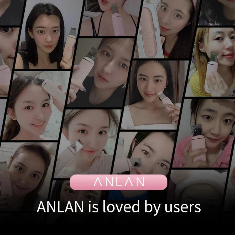 ANLAN Ultrasonic Skin Scrubber Deep Cleaning Peeling Shovel Limpiador Facial Skin Care Face Lifting Machine Ultrasonic Cleaner