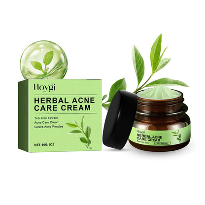 Acne Face Cream Pimple Treatment Oil Control Repair Redness Remove Blackhead Smooth Hydrating Moisturizing Pore Shrinking Serum - AMULET RING STORE