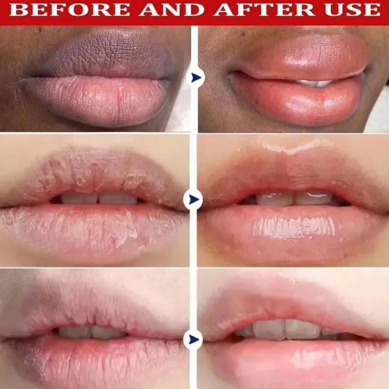 Exfoliating Lip Treatment Mask Gloss - Lightening Melanin Dark Lip Balm Remove Pink Moisturizing Reduce Lip Lines Improve Drynes - AMULET RING STORE