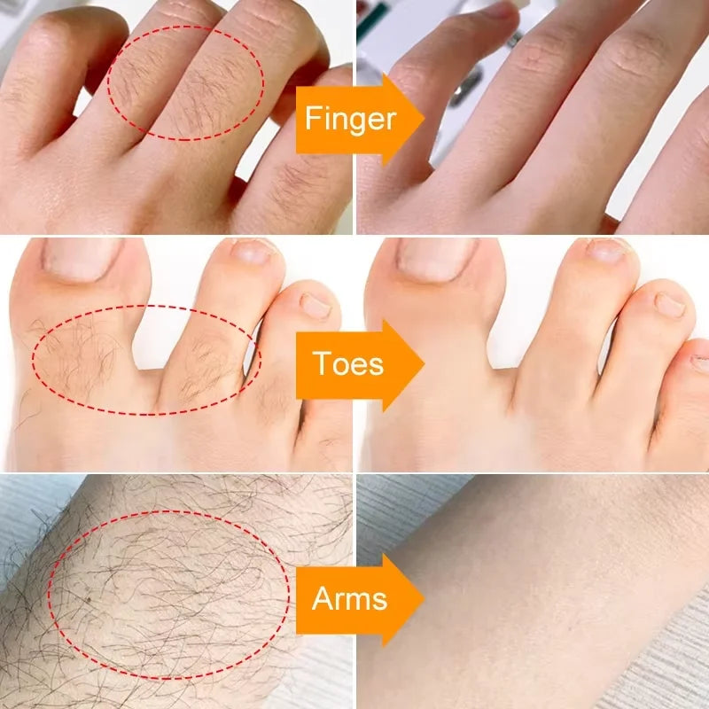 3 Minutes Fast Hair Removal Cream Painless Hair Growth Inhibitor Lip Face Arm Armpit Leg Permanent Depilatory for Men Women Care - AMULET RING STORE