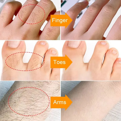 3 Minutes Fast Hair Removal Cream Painless Hair Growth Inhibitor Lip Face Arm Armpit Leg Permanent Depilatory for Men Women Care - AMULET RING STORE