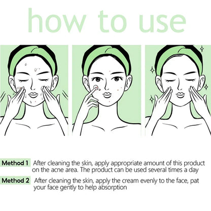 Pore Shrinking Cream Acne Pit Repair Products for Men and Women Remove acne mark scars Large pore anti-inflammatory smooth skin - AMULET RING STORE