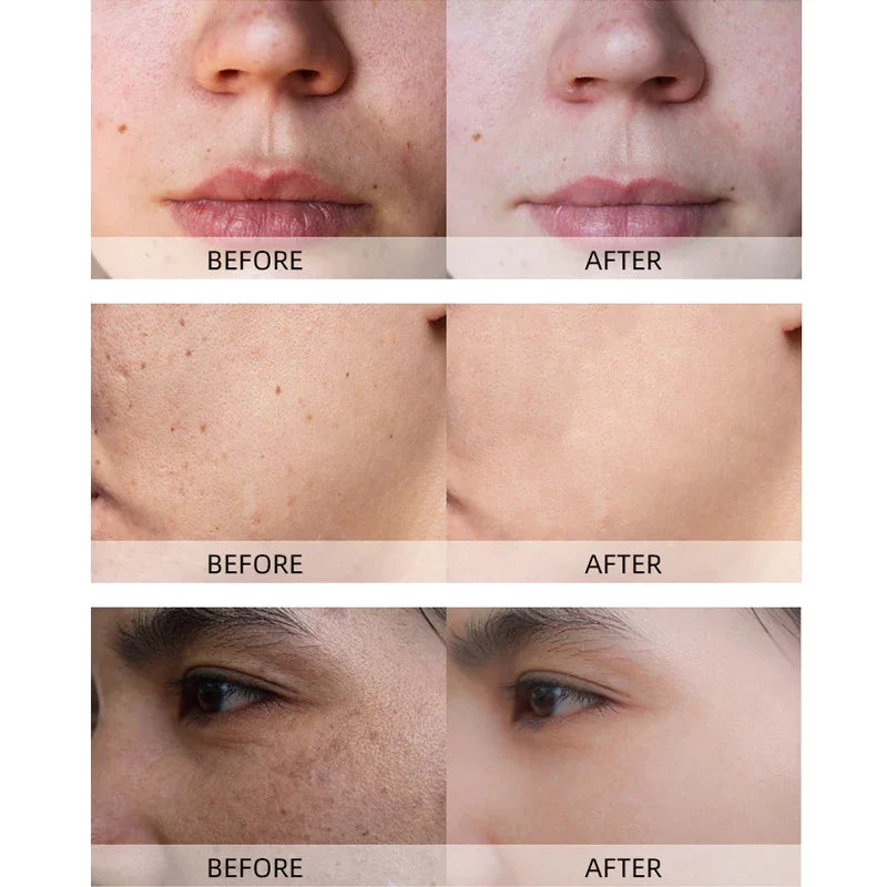 Turmeric lemon Skin Care products Acne Dark Spot Remover Whitening Brighten Facial Serum Face Cream Cleanser Serum Oil Cosmetics