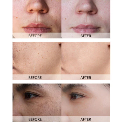 Turmeric lemon Skin Care products Acne Dark Spot Remover Whitening Brighten Facial Serum Face Cream Cleanser Serum Oil Cosmetics