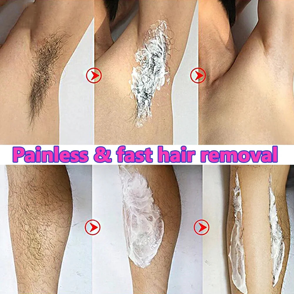 Fast Hair Removal Cream Painless Hair Growth Inhibitor Arm Armpit Legs Permanent Depilatory for Men Women Beauty Body Care 60g - AMULET RING STORE