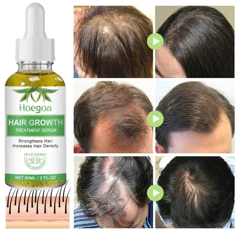 Fast Hair Growth Oil Africa Crazy Traction Alopecia Serum Anti Hair Break Thicken Hair Loss Treatment Spray For Man Women 60ML