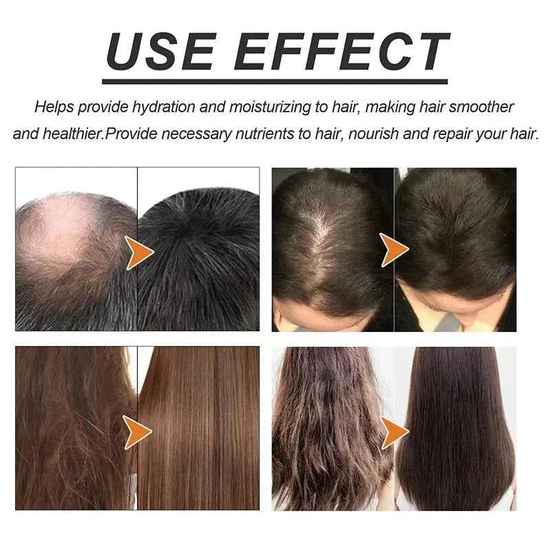 Fast Hair Growth Oil Rosemary Africa Crazy Traction Alopecia Serum Anti Hair Break Thicken Hair Loss Essential Oil For Man Women
