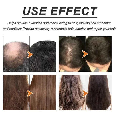 Fast Hair Growth Oil Rosemary Africa Crazy Traction Alopecia Serum Anti Hair Break Thicken Hair Loss Essential Oil For Man Women