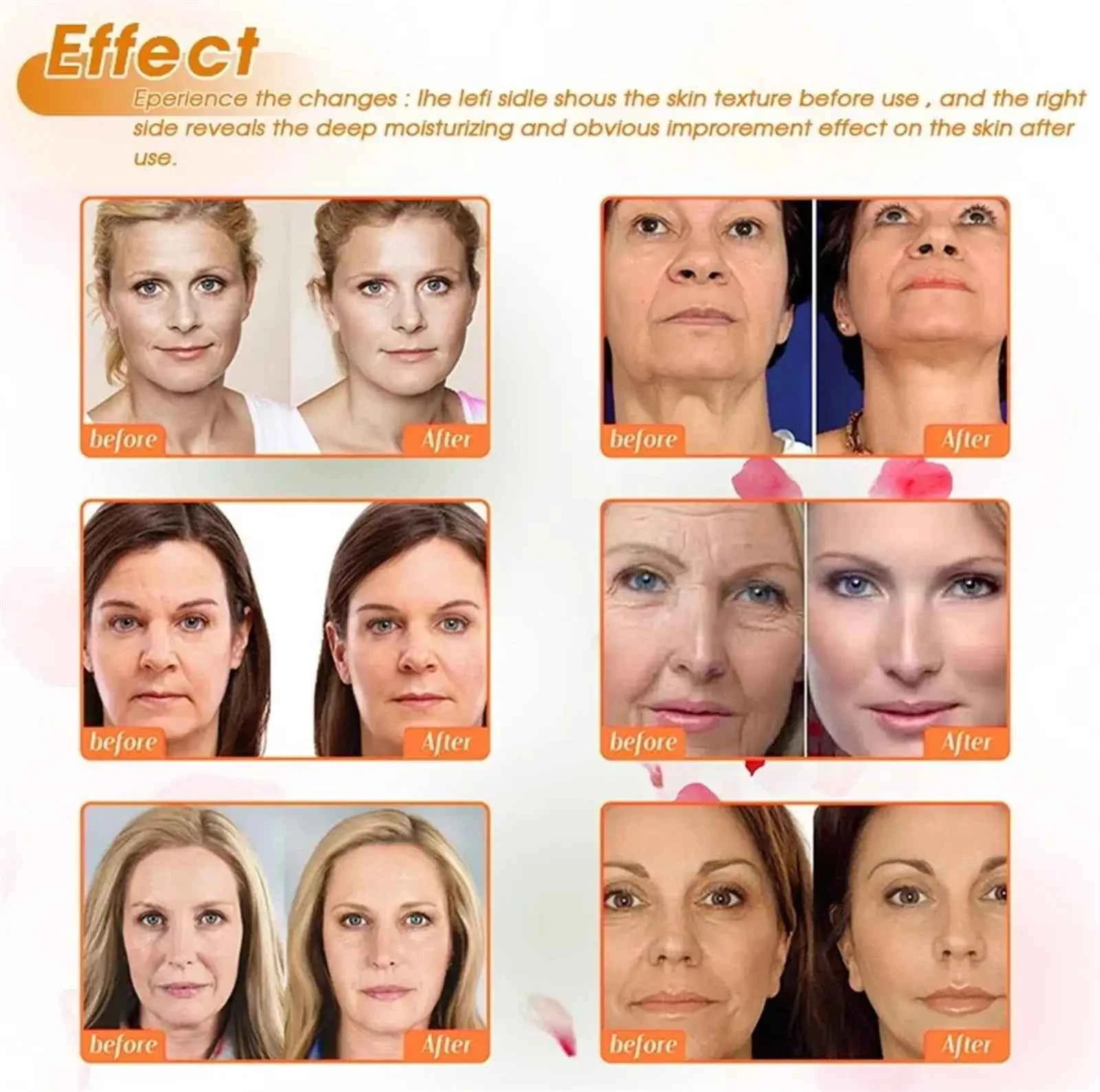 Bee Venom Instant Wrinkle Repair Cream Facial Anti-Aging Rejuvenate Fade Lines Firming Lifting Tightening Moisturizing Skincare