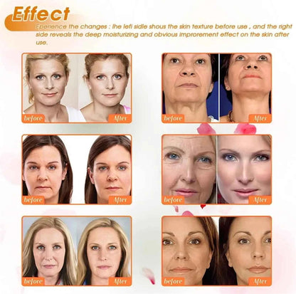 Bee Venom Instant Wrinkle Repair Cream Facial Anti-Aging Rejuvenate Fade Lines Firming Lifting Tightening Moisturizing Skincare