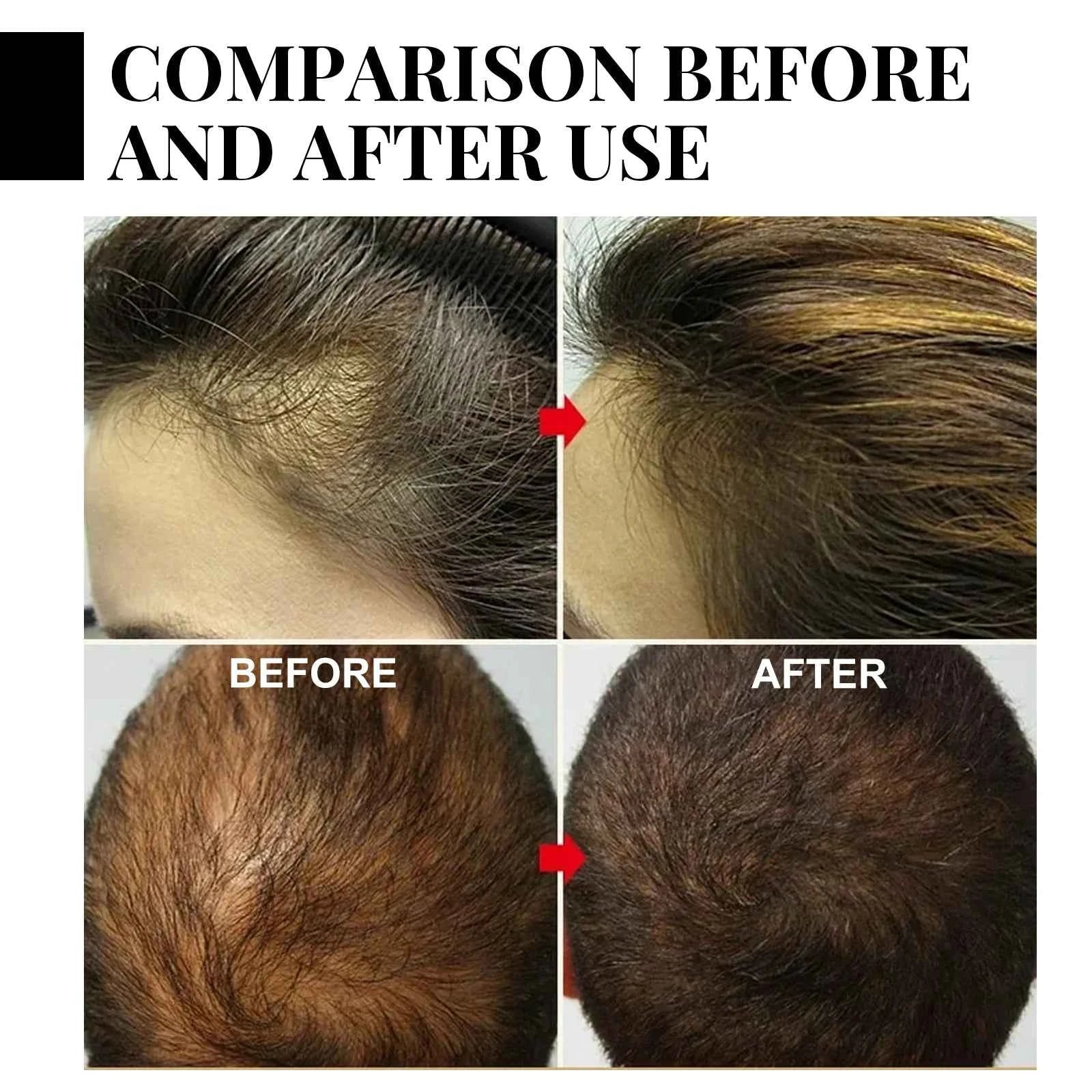Fast Hair Growth Set Batana Oil Traction Alopecia Hair Mask Anti Break Loss Hair Growth Oil Baldness Treatment Hair Health Care