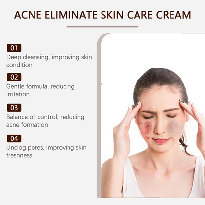 Pore Shrinking Cream Acne Pit Repair Products for Men and Women Remove acne mark scars Large pore anti-inflammatory smooth skin - AMULET RING STORE