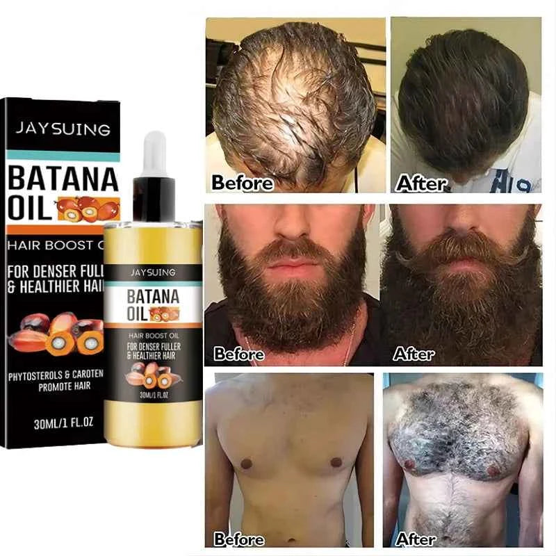 Fast Hair Growth Set Batana Oil Traction Alopecia Hair Mask Anti Break Loss Hair Growth Oil Baldness Treatment Hair Health Care