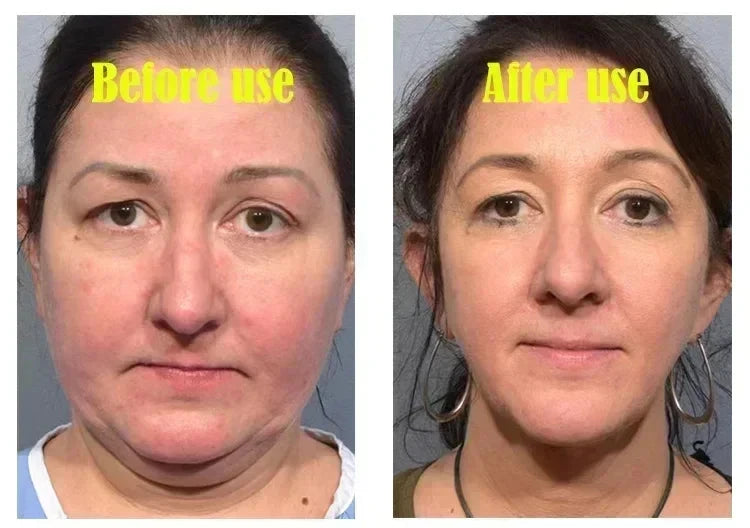 Effective V-Shape Face Slimming Lifting Facial Cream Lift Up V Double Chin Cheek Slimming Firming Anti Wrinkle Beauty Skin Care - AMULET RING STORE