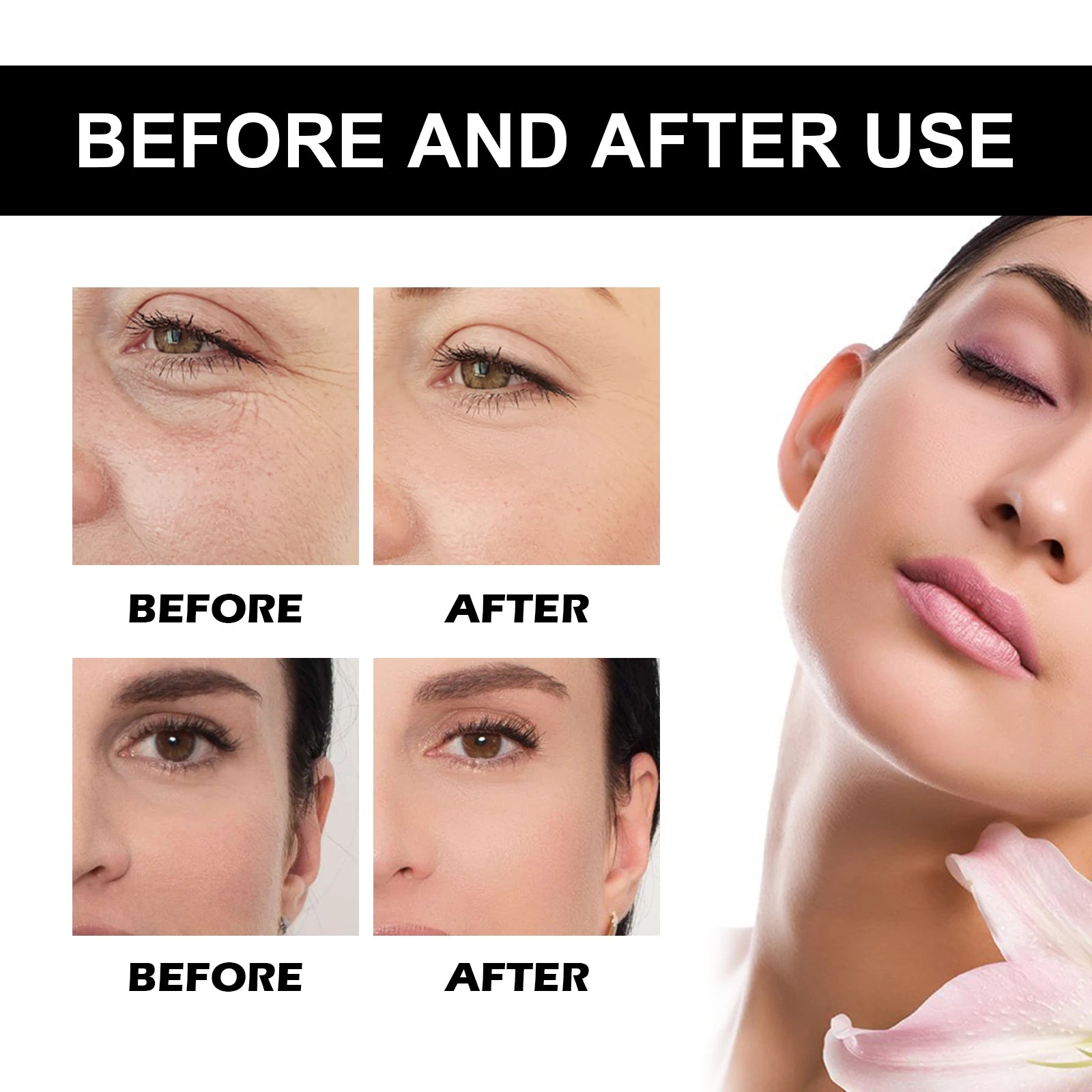 Vitamin C Serum For Face Dark Spot Removal Niacinamide Moisturizing Brightning Shrink Pores Essence Beauty Firming Skincare 109g - AMULET RING STORE