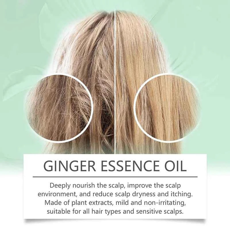 Ginger Hair Growth Serum 7 Days Fast Regrowth Essential Oil Anti Hair loss Prevent Hair Dry Frizzy Damaged Repair Care Products