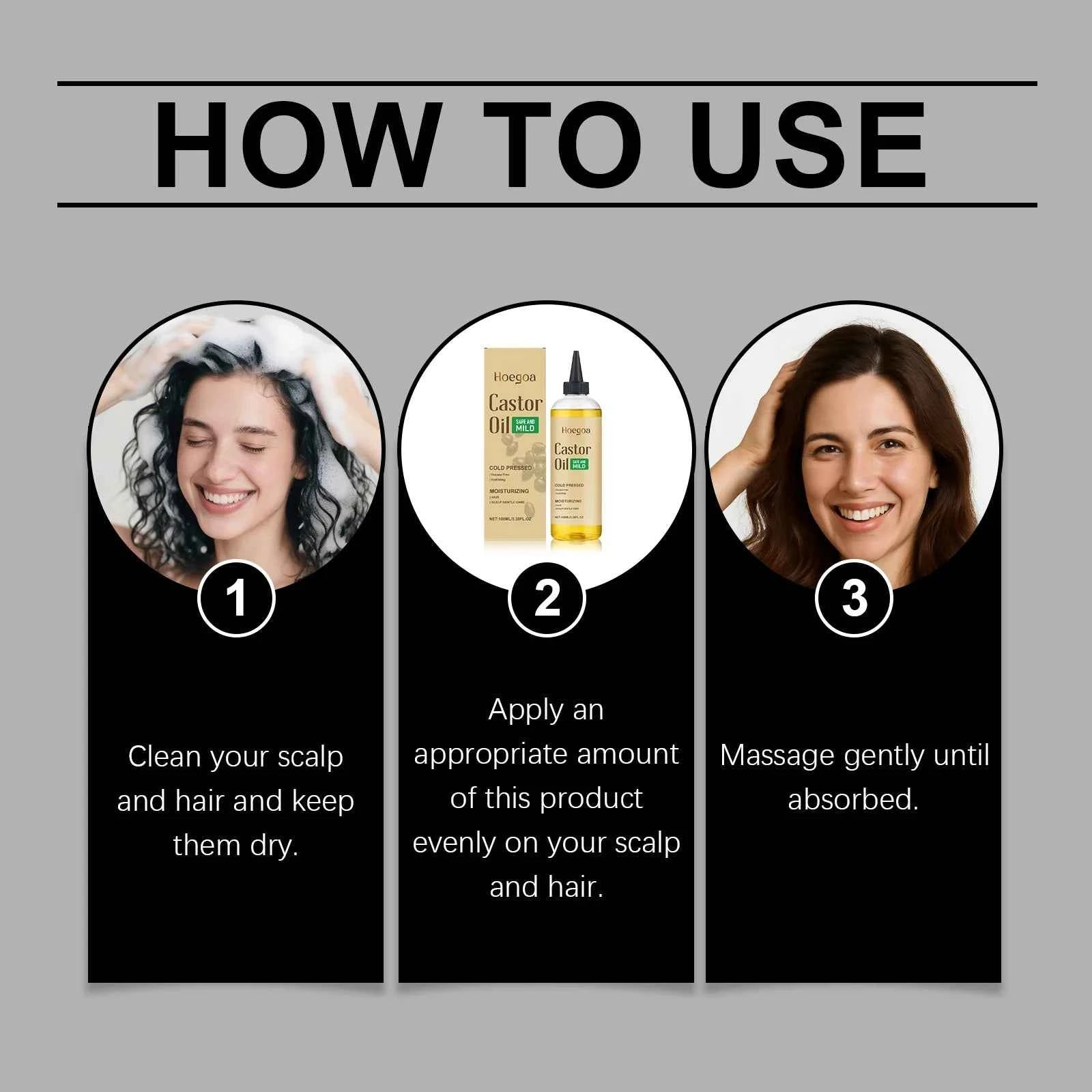 Hair Booster Castor Oil Hair Essence Treatment Improve Androgenetic Alopecia Scalp Treatment Serum Strengthen Hair Roots