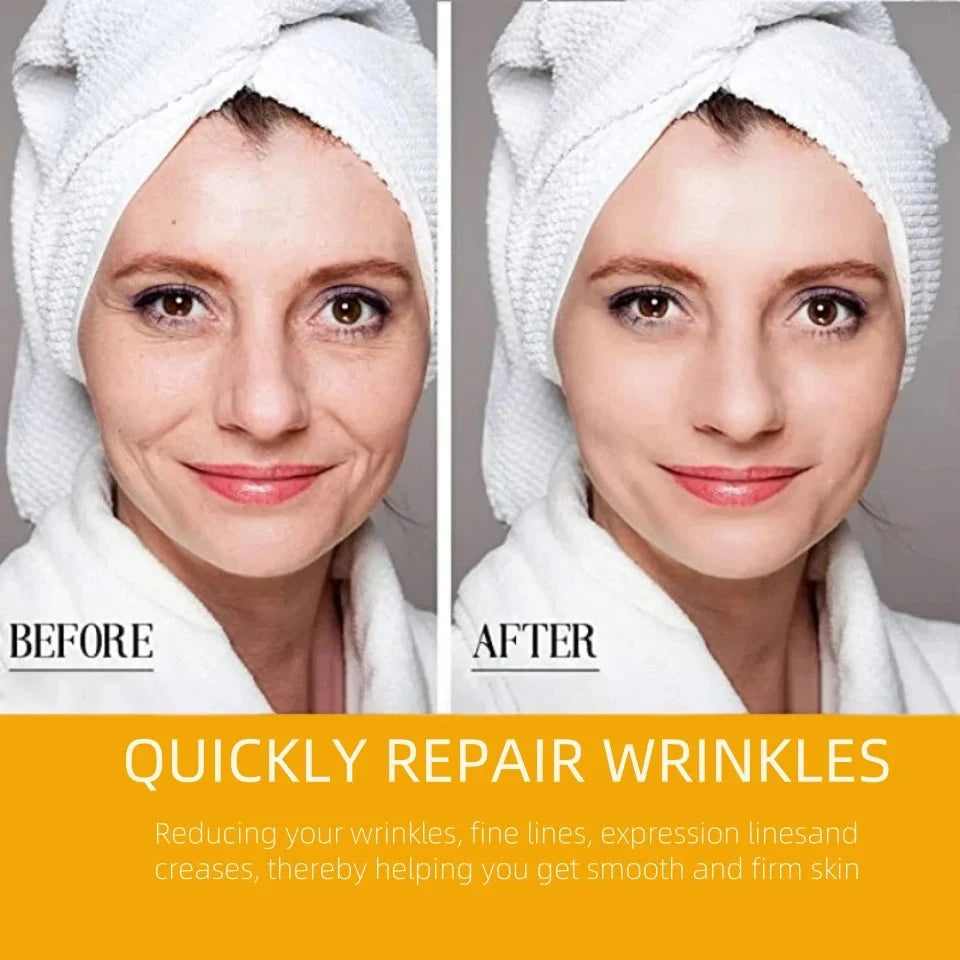 Nasolabial Folds Patch Contain Collagen Hyaluronic Acid Firming Skin Fade Fine Lines Deep Moisturizing Facial Mask Anti Wrinkle