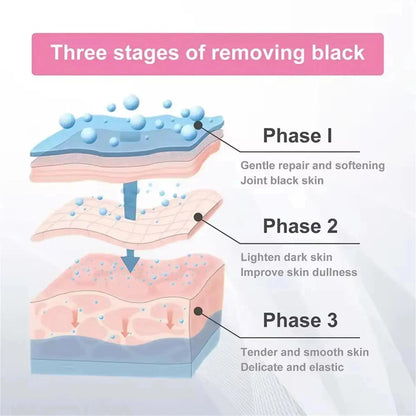 Whitening Cream Private Parts Underarm Bleaching Serum Whiten Butt Knee Brighten Inner Thigh Intimate Parts Dark Remove Melanin