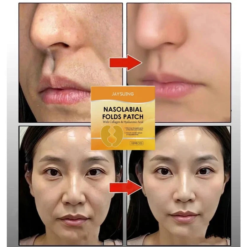 Nasolabial Folds Patch Contain Collagen Hyaluronic Acid Firming Skin Fade Fine Lines Deep Moisturizing Facial Mask Anti Wrinkle
