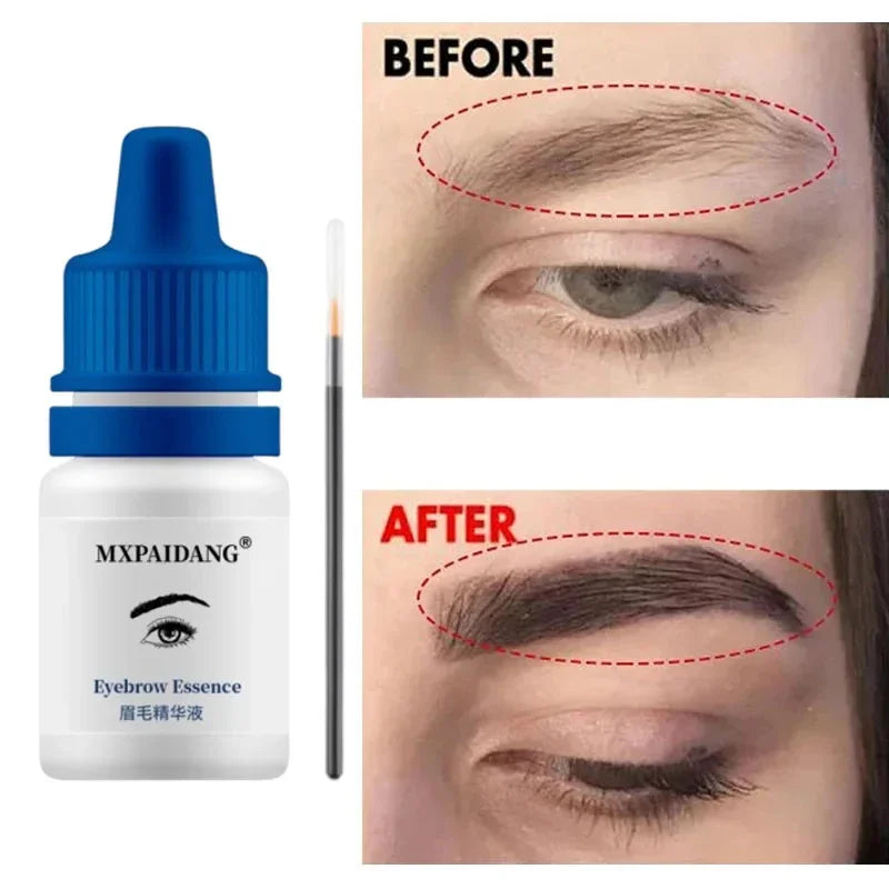 Fast Eyebrow Growth Serum Eyelash Hair Growth Anti Hairs Loss Product Prevent Baldness Fuller Thicker Lengthening Eyebrow Makeup - AMULET RING STORE