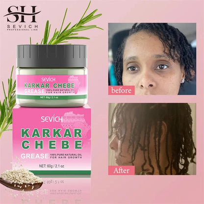 100% Pure Natural KARKAR Butter Hair Growth Oil Anti-Hair Loss Oil Repair Damaged Scalp Treatment Serum Oil For All Hair Types