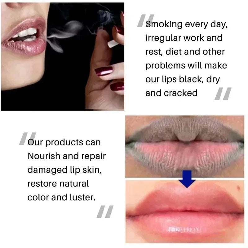 Remove Dark Lip Balm Fast Lightening Pink Lip Exfoliating Fade Lip Line Dead Skin Moisturizer Korean Care Products Beauty Health - AMULET RING STORE