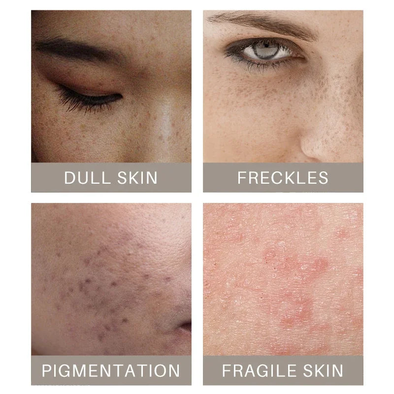 Turmeric lemon Skin Care products Acne Dark Spot Remover Whitening Brighten Facial Serum Face Cream Cleanser Serum Oil Cosmetics