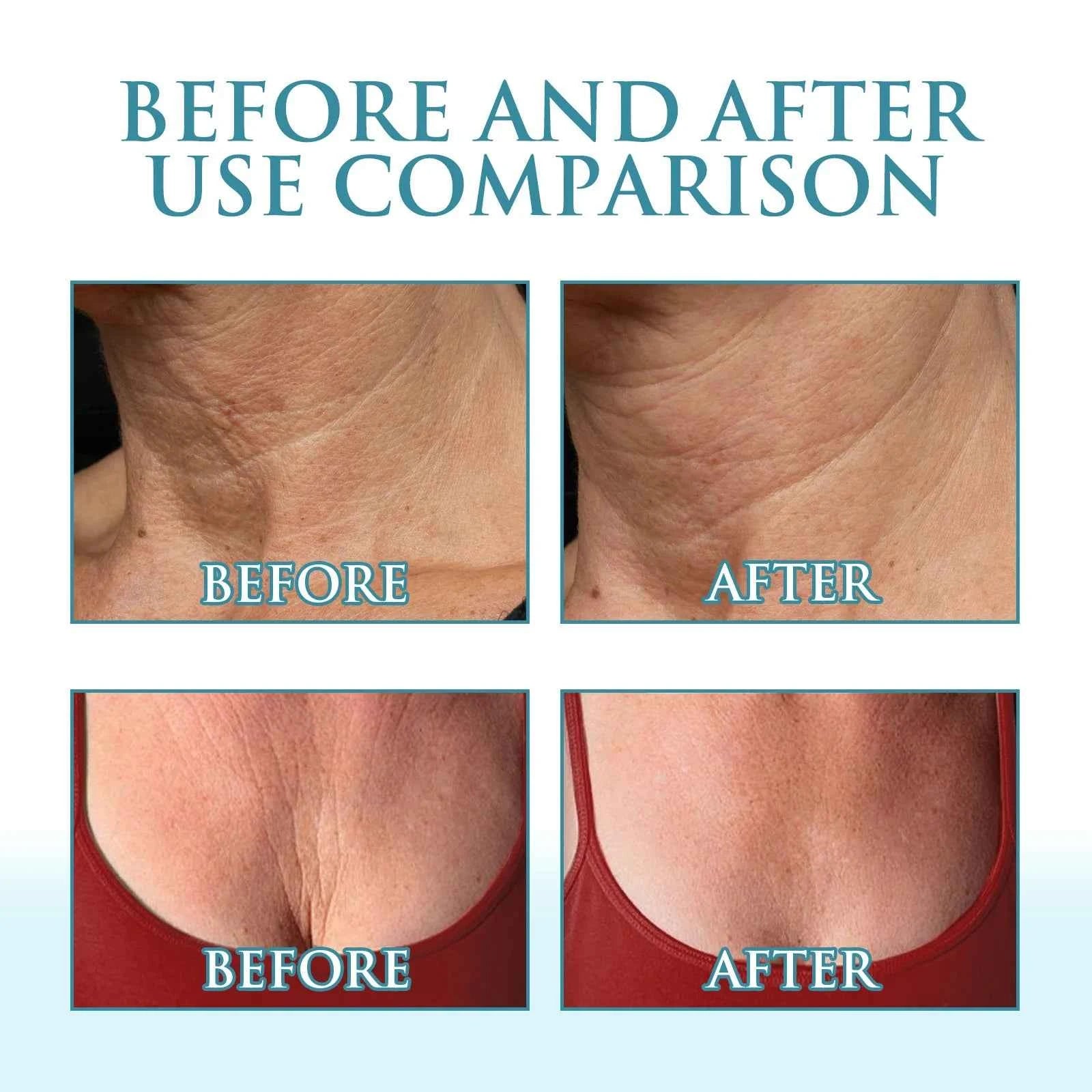 Niacinamide Cream Reduces Fine Lines, Contains Hyaluronic Acid, Moisturizing, Firming and Brightening Skin Care Products