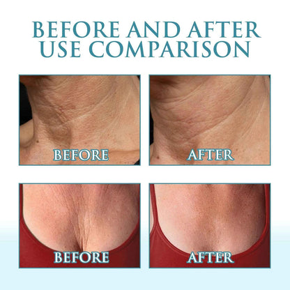 Niacinamide Cream Reduces Fine Lines, Contains Hyaluronic Acid, Moisturizing, Firming and Brightening Skin Care Products