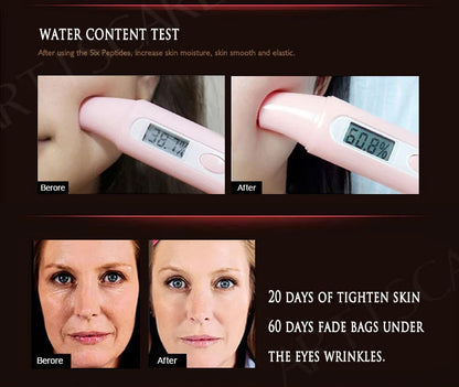 ARTISCARE Aging & Beauty Eyes Serum SET Anti Dark Circles Wrinkles Removal Coenzyme Q10 Six Peptides cream 3Pcs