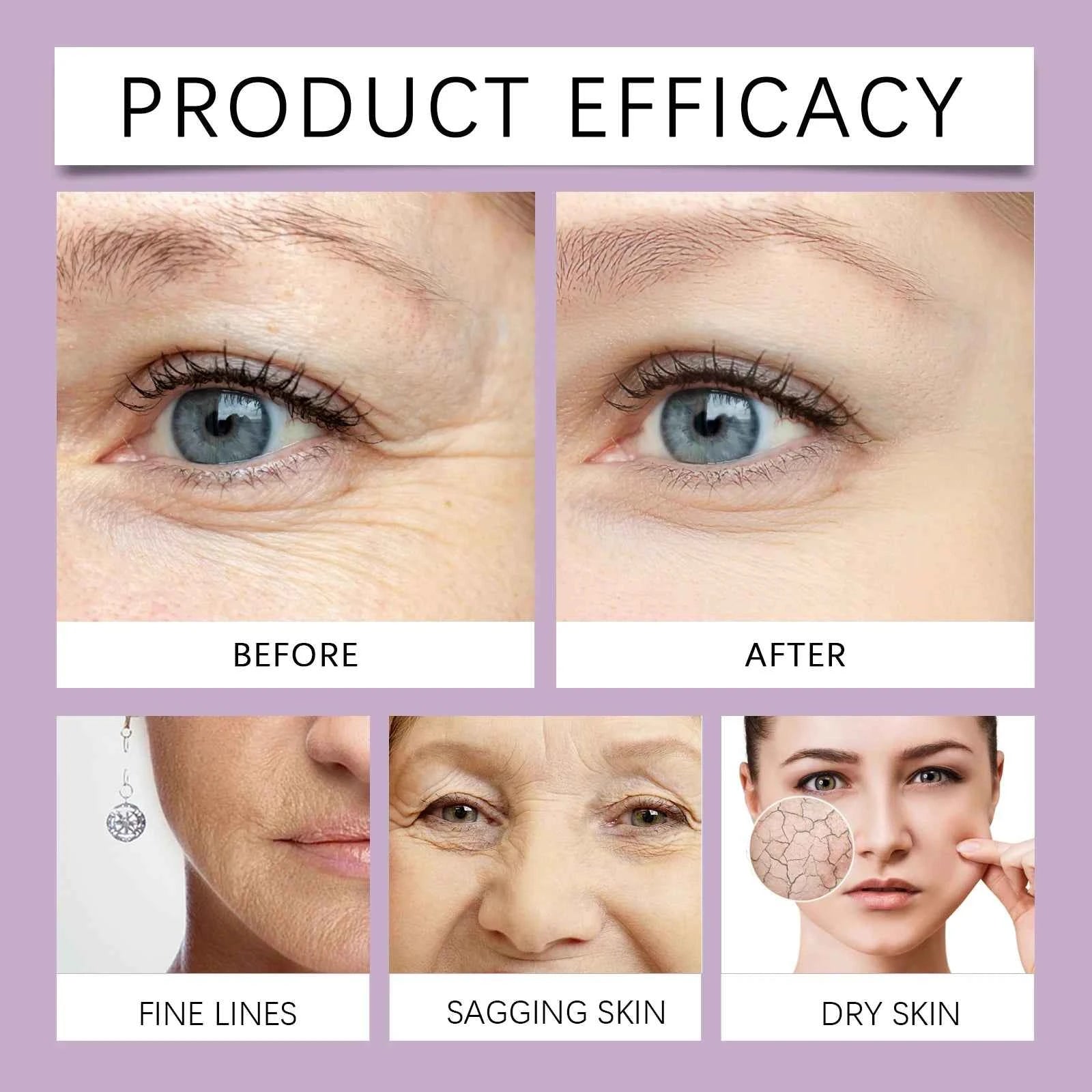 Retinol Facial Anti Wrinkle Essence  Hydrating Firming Treatment, Lifts & Smooths Fine Lines, Nourishing, 30ml