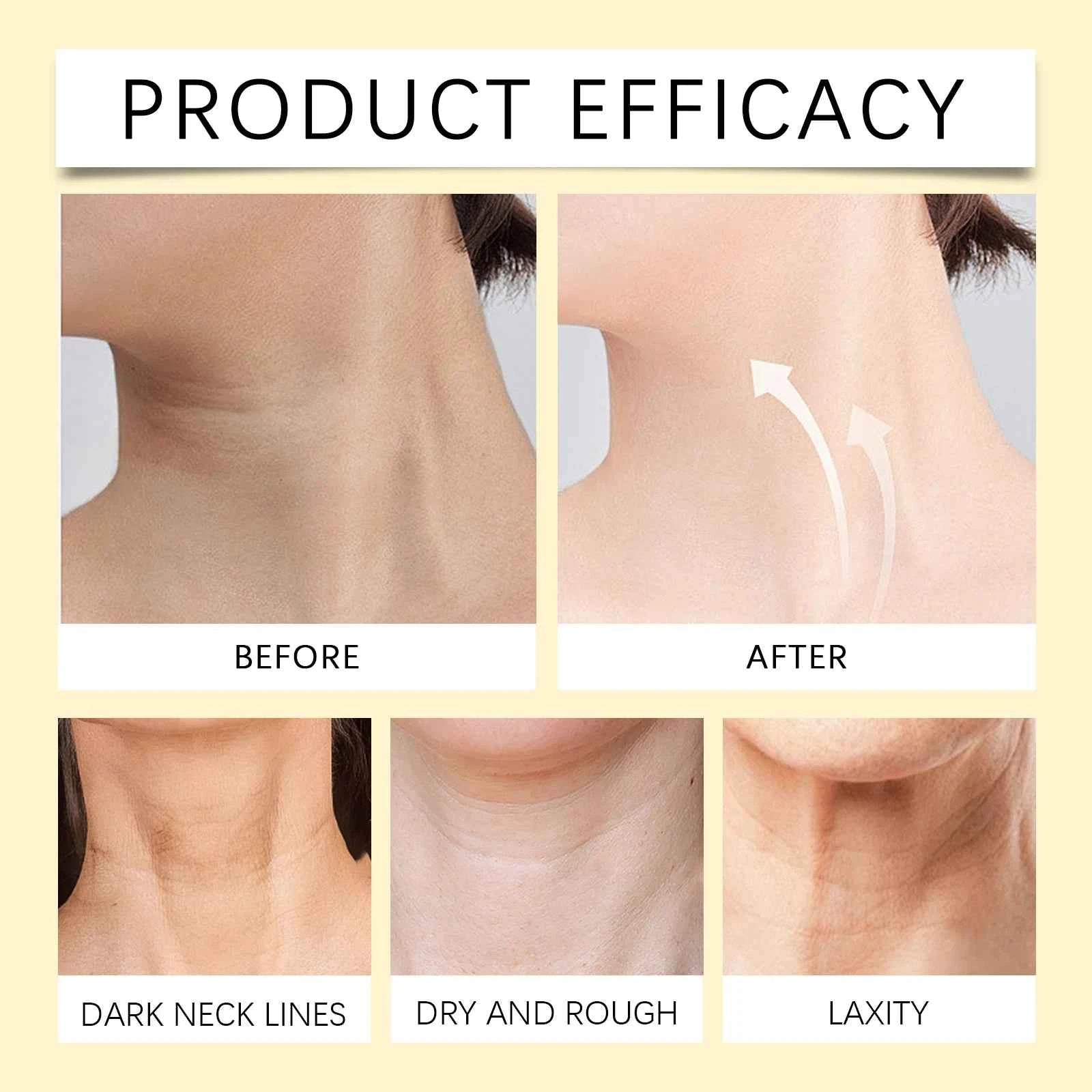 EELHOE 40g Bee Venom Cream Stick Firming Skin Lighten Neck Lines Fade Fine Wrinkle Moisturizing Improve Skin Sagging Facial Care